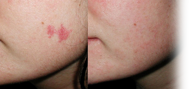 Cand trebuie sa contactez un medic specialist?